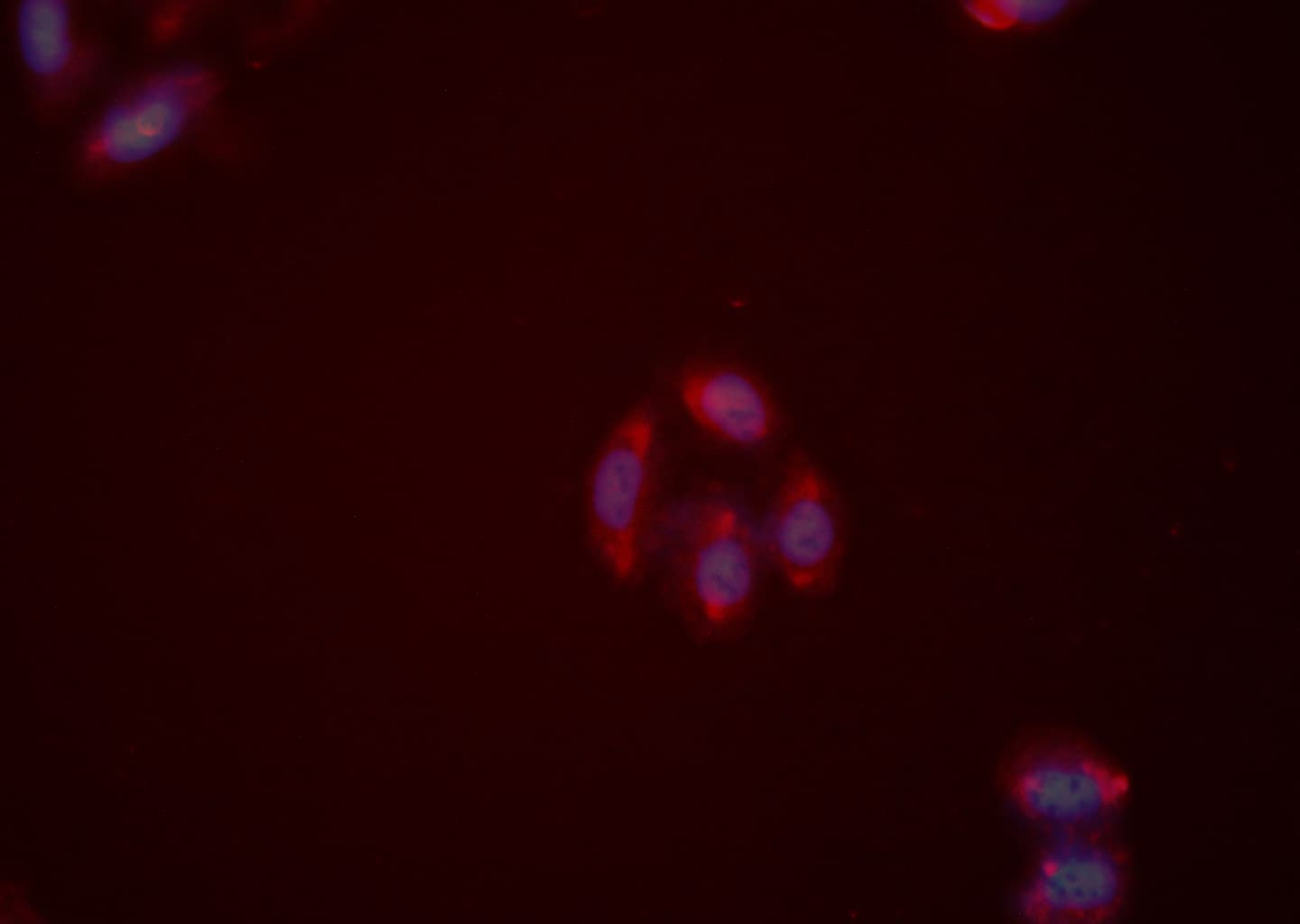 NPY2R Antibody