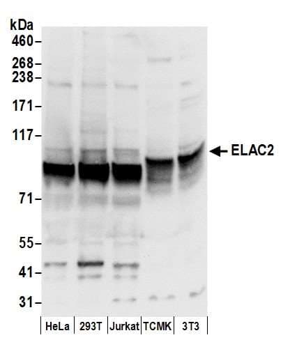 Polyclonal Rabbit anti-Human ELAC2 Antibody (aa776-826, IHC, WB)