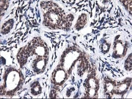 ALS2CR1 / NIF3L1 Antibody (clone OTI4B5)