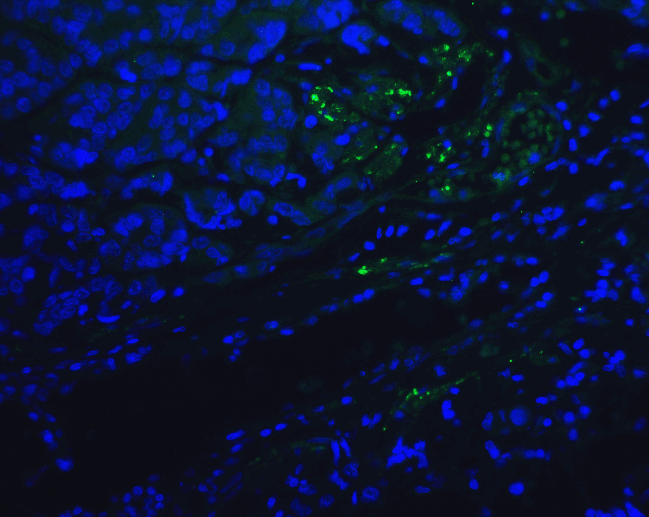 PathPlus™ Monoclonal Mouse anti-Human PDCD1 / CD279 / PD-1 Antibody (clone 5D3, IHC, IF)