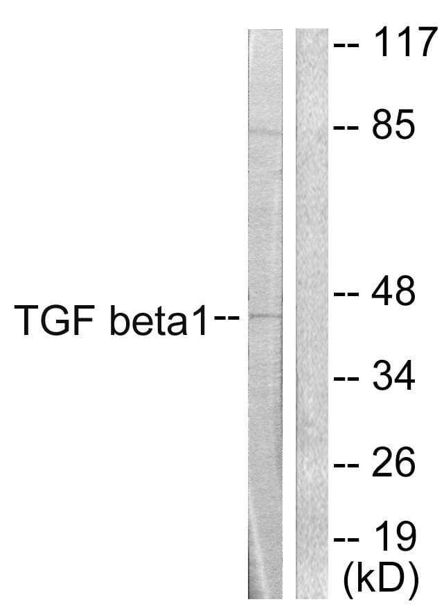 Polyclonal Rabbit anti-Human TGFB1 / TGF Beta 1 Antibody (IHC, WB)