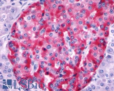 IHC-plus™ SSTR2 Antibody (Extracellular Domain)