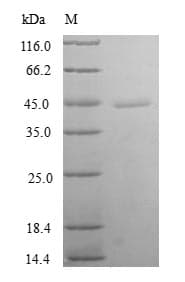 Human TXNL4B Protein (Recombinant GST, N-terminus)