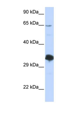 Polyclonal Rabbit anti-Human ZNF630 Antibody (C-Terminus, WB)