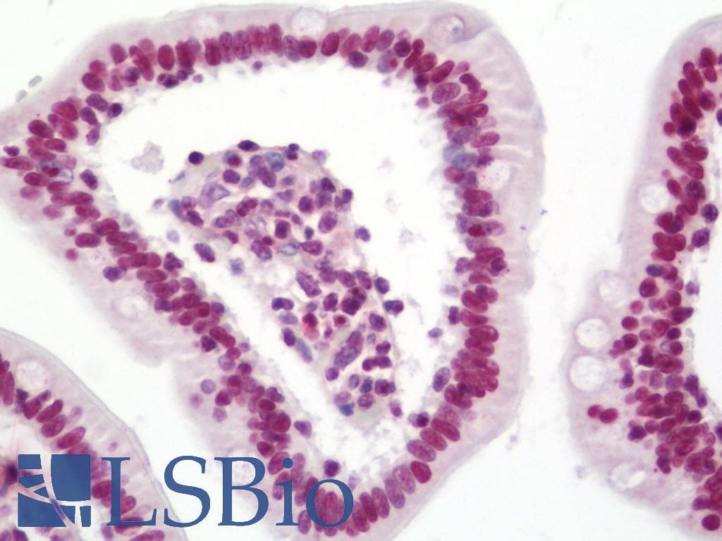 IHC-plus™ Polyclonal Rabbit anti-Human SNAI1 / SNAIL-1 Antibody (aa215-264, IHC, WB)