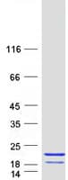Human PPP3R2 Protein (Recombinant Myc-DDK (Flag))
