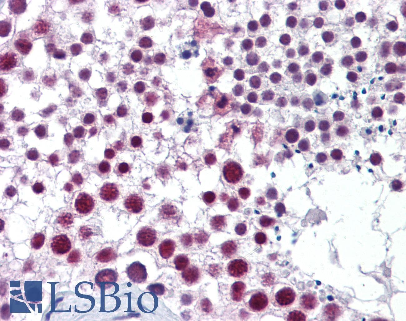 IHC-plus™ CCNH / Cyclin H Antibody (clone 1B8)