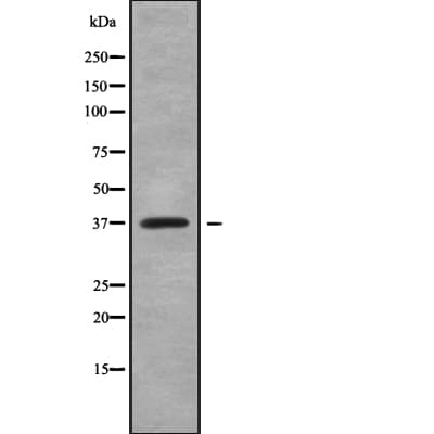 Polyclonal Rabbit anti-Human TCF19 / TCF-19 Antibody (IHC, IF, WB)