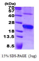 Human SDC4 / Syndecan 4 Protein (Recombinant)