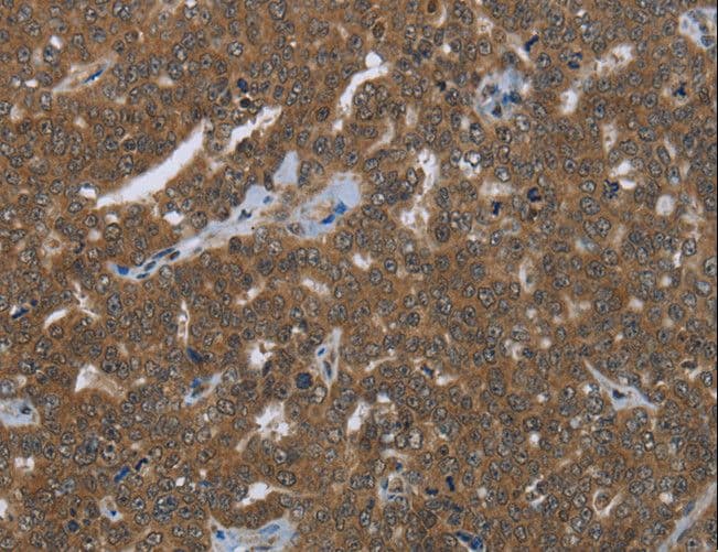 FASTKD1 Antibody