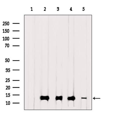 Polyclonal Rabbit anti-Human TIMM13 Antibody (WB)