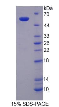 Mouse SPTLC3 / C20orf38 Protein (Recombinant His-T7)