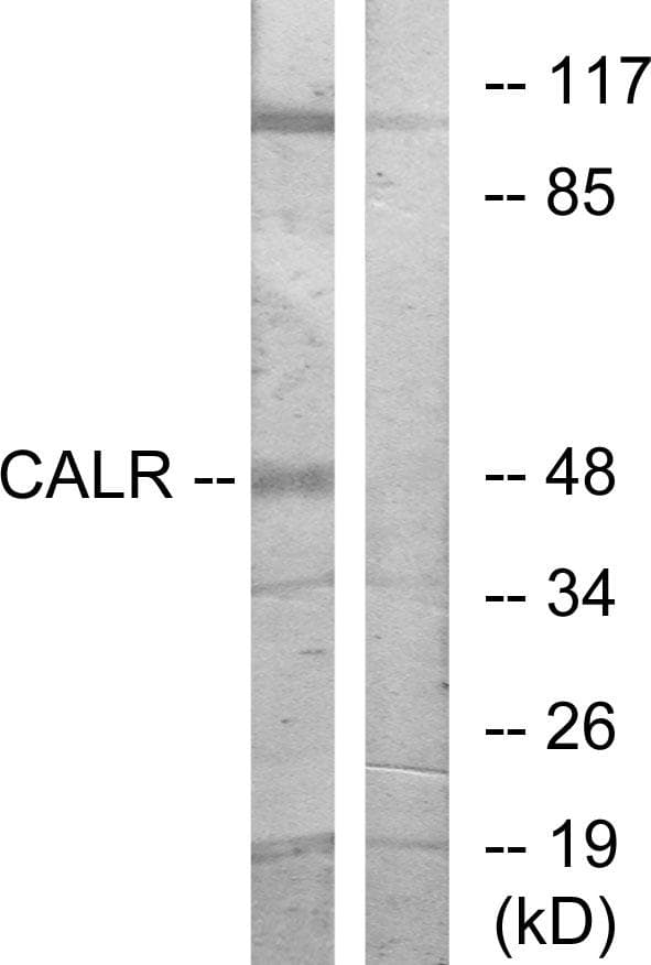 Polyclonal Rabbit anti-Human CALR / Calreticulin Antibody (IHC, IF, WB)