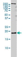 PTN / Pleiotrophin Antibody (clone 5C3)