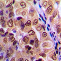 Polyclonal Rabbit anti-Human PRKACA + PRKACB + PRKACG Antibody (Internal, IHC, IF, WB)
