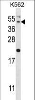 HAVCR1 / KIM-1 Antibody (aa53-82)
