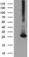 GSTT2 Antibody (clone OTI8A10)