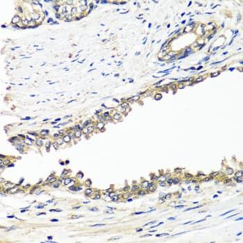 Polyclonal Rabbit anti-Human BRCA1 Antibody (IHC, IF, WB)