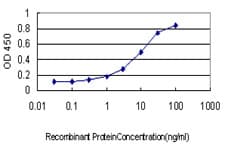 PIKFYVE / PIP5K Antibody (clone 6C7)