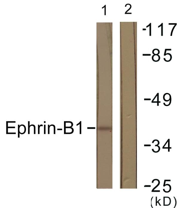 EFNB1 / Ephrin B1 Antibody (p317)