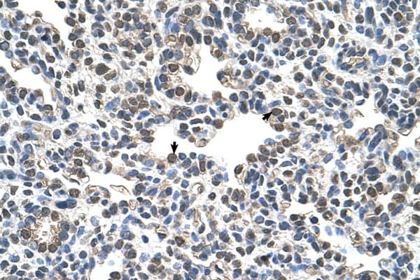 Polyclonal Rabbit anti-Human CIZ1 Antibody (Biotin, C-Terminus, IHC, WB)