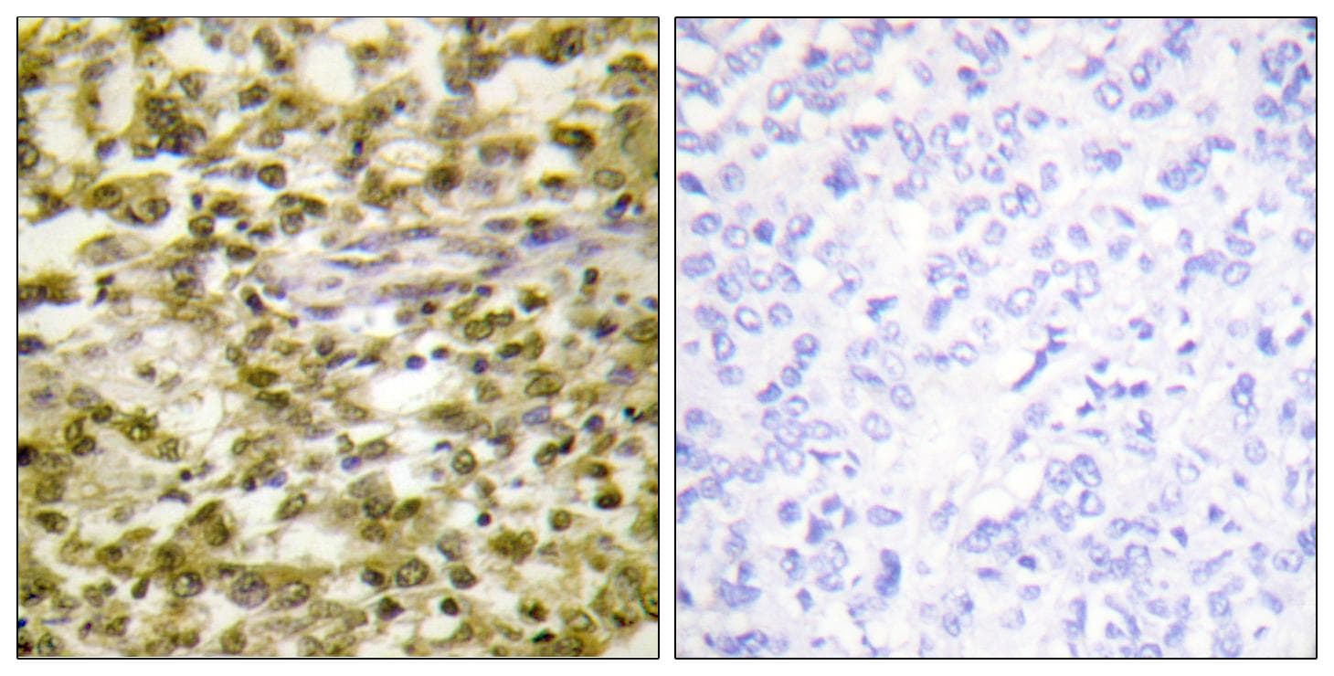 ERCC6 / CSB Antibody
