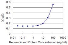 IHC-plus™ CCBL1 Antibody (clone 1B12)