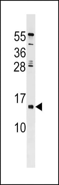 HHLA3 Antibody (aa75-101)