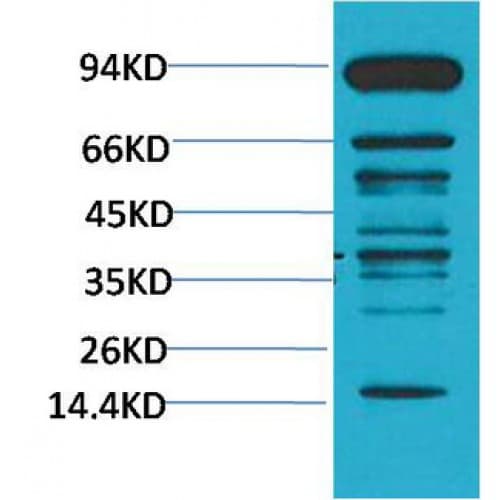 Methyl-Lysine Antibody (clone Mix)