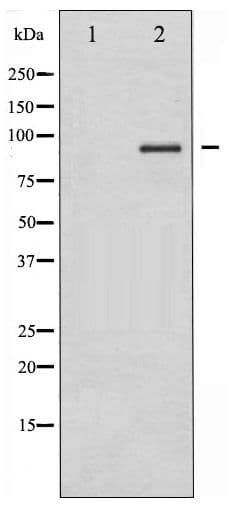 Polyclonal Rabbit anti-Human IKK Alpha+Beta Antibody (IHC, WB)