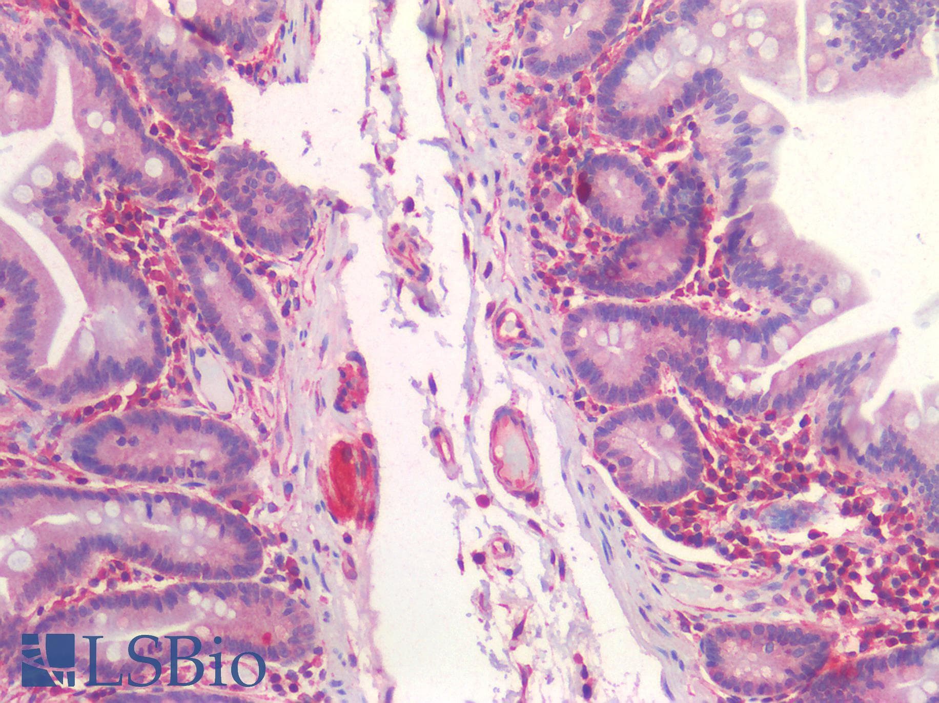 IHC-plus™ Polyclonal Rabbit anti-Human SST / Somatostatin Antibody (IHC)