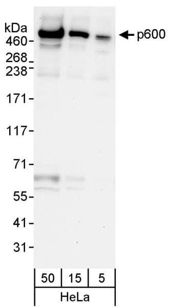 UBR4 Antibody (aa5133-5183)