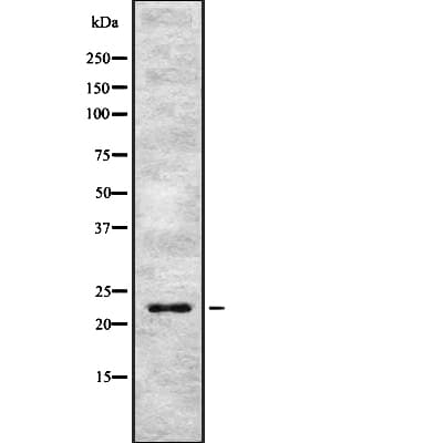 APG12 / ATG12 Antibody