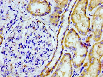 PTGR2 / PGR2 Antibody