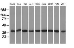ACAT2 Antibody (clone OTI1C5)