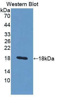 Properdin / CFP Antibody (aa65-190, APC)