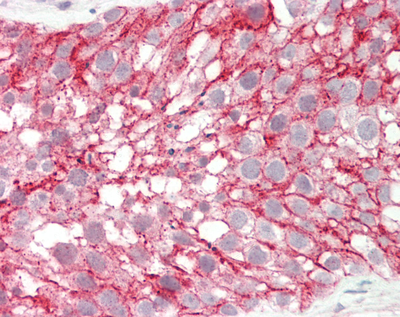 CTAGE5 Antibody (aa143-192)