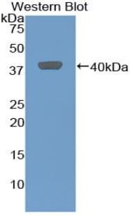MIP2 / GRO2 / CXCL2 Antibody (aa32-100)