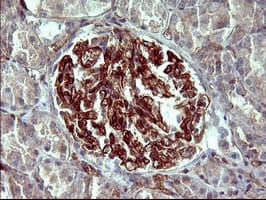 PAP2a / PPAP2A Antibody (clone OTI1H4)