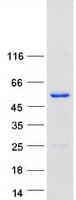 Human TOM1 Protein (Recombinant Myc-DDK (Flag))