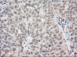ACAT2 Antibody (clone OTI5F7)