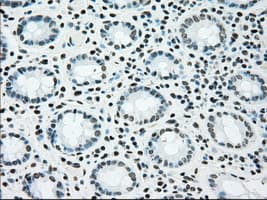 Monoclonal Mouse anti-Human BRAF / B-Raf Antibody (clone OTI4G6, IHC, WB)