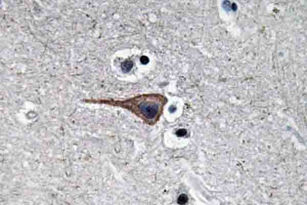 EGF Antibody (Arg709)