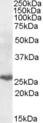 IHC-plus™ PSMB10 Antibody (aa231-242)