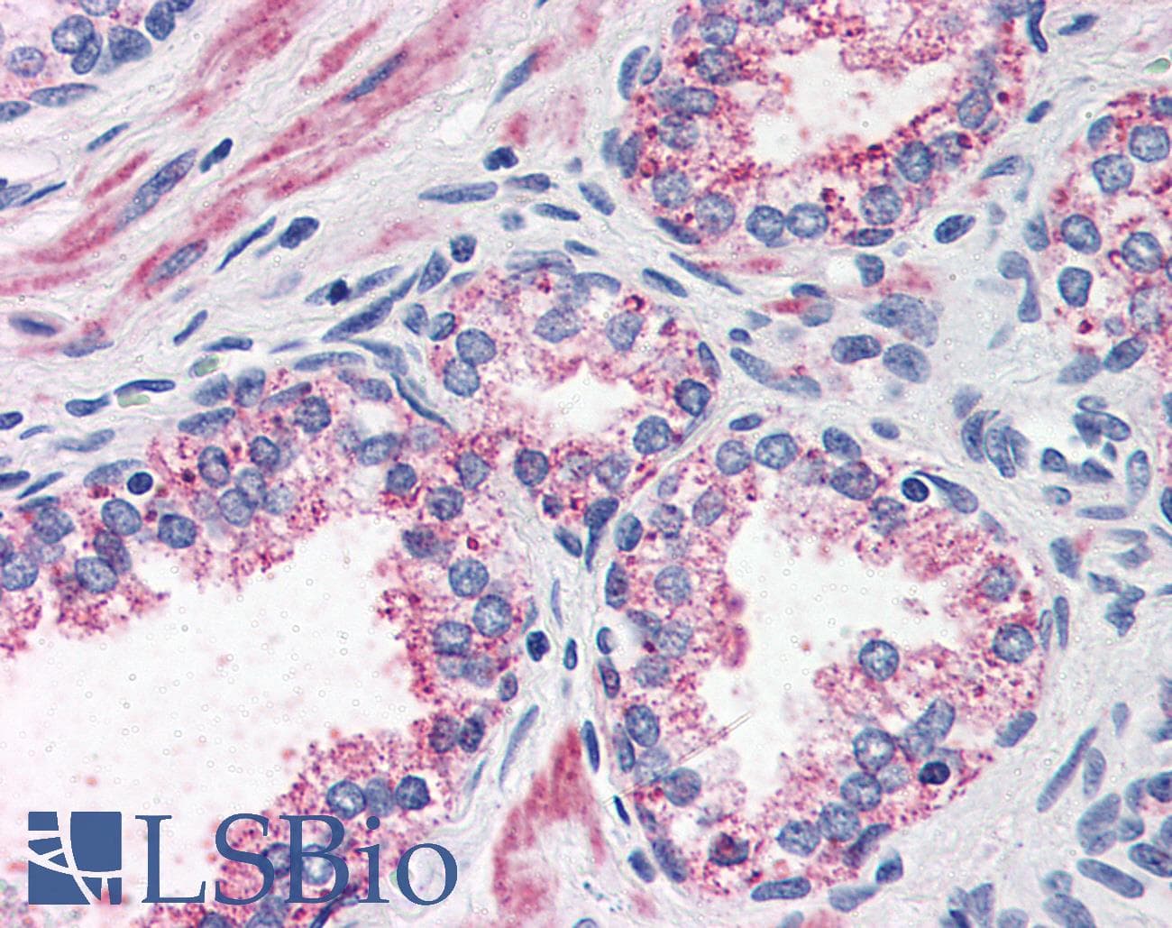 IHC-plus™ Polyclonal Rabbit anti-Human CCKAR / CCK1R Antibody (Internal, IHC)