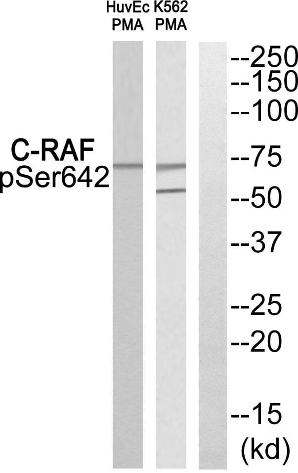 RAF1 / RAF Antibody (phospho-Ser642)