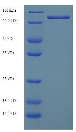 Human GDAP2 Protein (Recombinant His-SUMO)