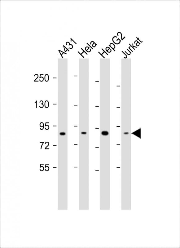 NEK10 Antibody (aa450-483)