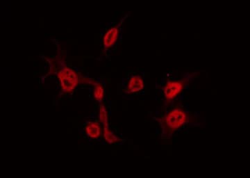 CDK5 Antibody (phospho-Tyr15)