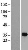 DTWD2 Protein (Over-Expression Lysate Myc-DDK (Flag))